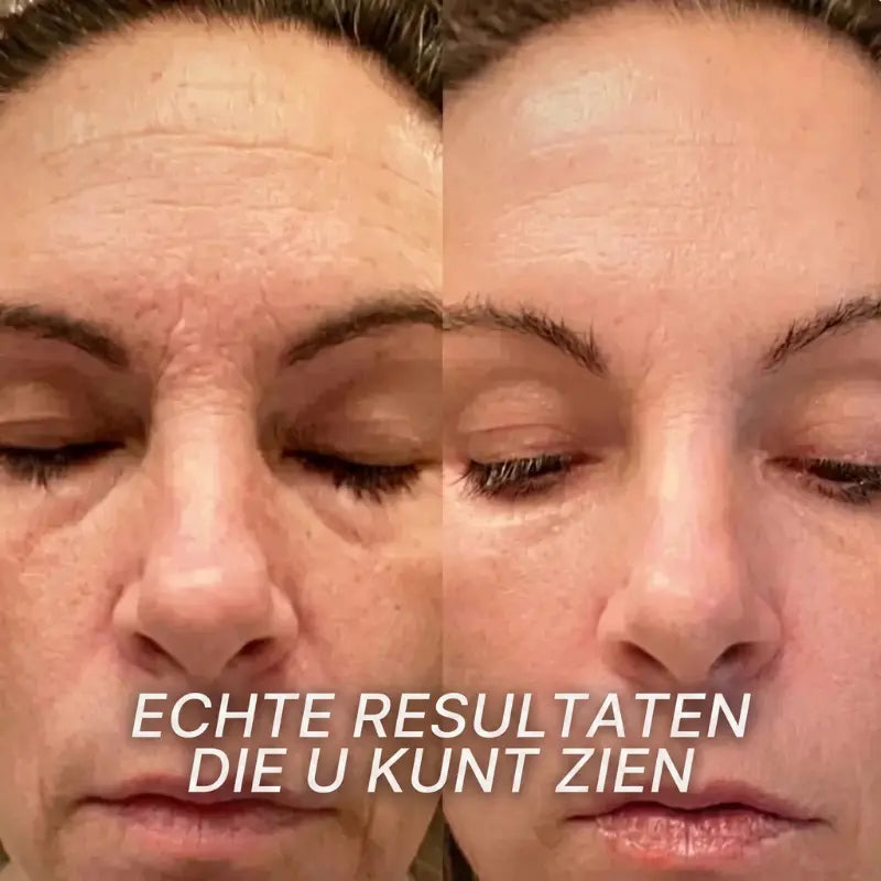 Leaf™ - Opvullende Bio-Collageen & PDRN Stick