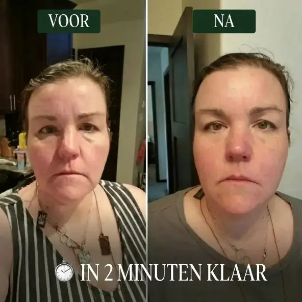 Lymfatische gezichtsborstel Skin Cura™