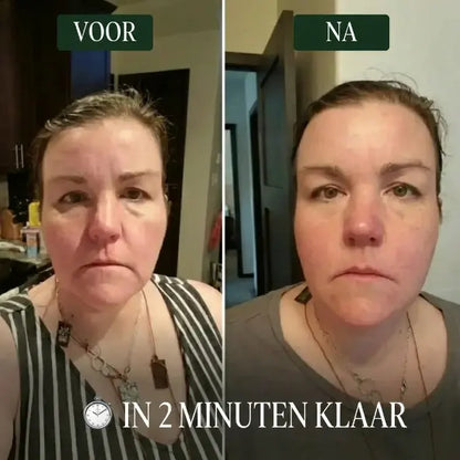Lymfatische gezichtsborstel Skin Cura™